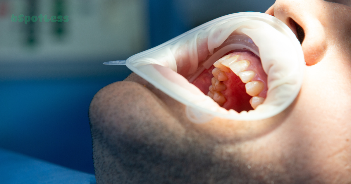 How To Get Rid Of Calcium Deposits On Teeth