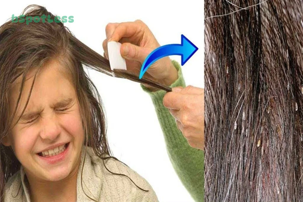How To Remove Nits From Hair Without A Comb